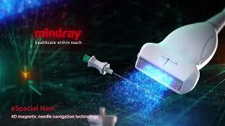 Mindray TE7(ACE) Diagnostic Ultrasound System - Dedicated Solution for the Pioneer of Care