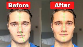 How to Fix Asymmetrical Jaw & Face (TODAY!)