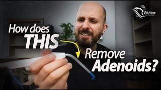 The weird way surgeons remove your adenoids.