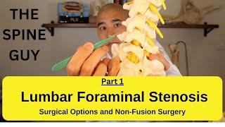 Lumbar Foraminal Stenosis - Surgical Options and Non-Fusion Surgery