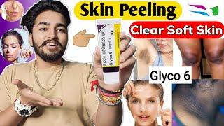 Glyco 6 Cream Review | Wonderful Results Of Glyco 6 Cream