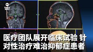 医疗团队展开临床试验 针对性治疗难治型抑郁症患者