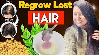 30 Days Challenge : Regrow Lost Hair, Fix Bald Patches & Receding Hairline Naturally in 30 Days