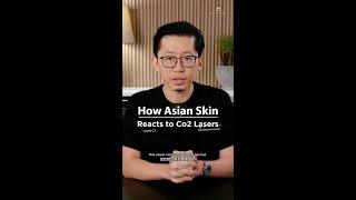 How Asian Skin Reacts to Lasers? | Ensoul Medical Clinic