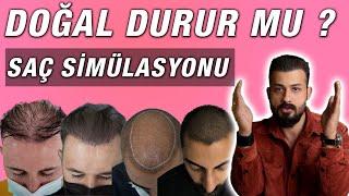 Saç Simülasyonu Doğal durur mu ? Boya gibi durur mu ? Uzm.Est.Semih DENİZ