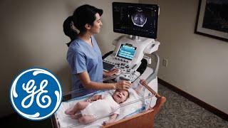 LOGIQ XDclear Family | GE Healthcare