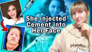 CEMENT injection in face | What are Asian women ready for beauty? | Dangerous beauty trends in Japan