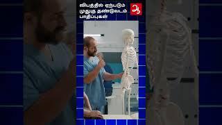 Road accident டில் அதிகம் பாதிக்கப்படும் Spinal cord | High chance of spinal cord damage in accident