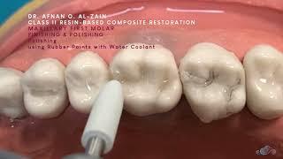 Class II composite restoration (2) – Horizontal incremental technique (#26) - Arabic عربي