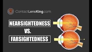 Nearsightedness Vs Farsightedness and the Difference Between the Two