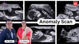 Anomaly Scan in pregnancy |Pregnancy ultrasound   what , when , how  & why |#ultrasoundinpregnancy