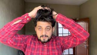 MY HAIR TRANSPLANT RESULTS AFTER 2 Years || My Hair Care Routine |  Hair Transplant Journey