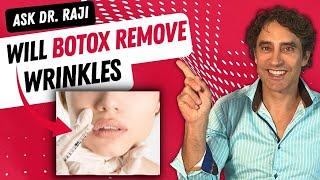 Will BOTOX REMOVE WRINKLES from A FACE // Botox Injections