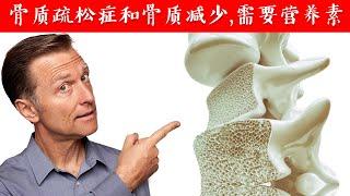 骨质疏松症和骨质减少,需要营养素 自然疗法,柏格医生dr berg