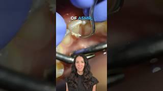 dental cleaning scaling teeth ASMR #shorts