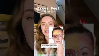 Improve Crows Feet | Face Yoga For Eyes | Reduce Wrinkles | All You Can Face #shorts