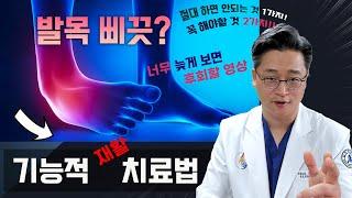 발목 삐끗했을 때 치료의 정석은 이겁니다!  자연 치유를 유도하는 기능적 재활 치료법!