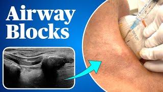 Airway Blocks for Awake Intubation