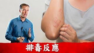 好轉反應 (排毒反應),如何修復症狀?柏格醫生 Dr Berg