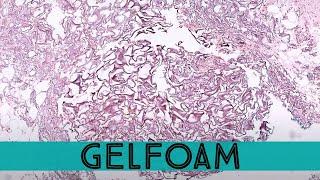 Gelfoam in skin (pathology dermpath dermatology dermatopathology)