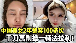 中國美女整容上癮，2年整容100多次，一張臉千刀萬剮換一輛法拉利！｜整容｜周楚娜｜明星觀察員