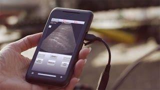Digital Health Care Revolution: An Inside Look