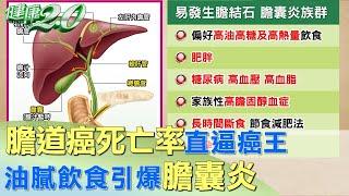 膽道癌死亡率直逼癌王 油膩飲食引爆膽囊炎 健康2.0