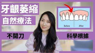 【Eng subs】牙齦萎縮 Gum Recession Natural Remedies 這些自然療法真的有科學根據！油拔法怎麼進行？｜Dr. Grace