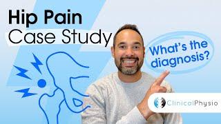 Hip Pain Case Study | Expert Physio Explains Hip Assessment and Diagnosis!