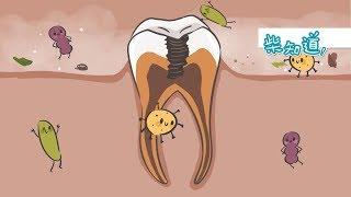 与300多种口腔细菌共处，如何保护牙齿？How to Prevent Dental Cavities?丨科普丨冷知识丨柴知道ChaiKnows