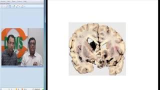 CRANIOPHARYNGIOMA : Radiology and Pathology Correlation