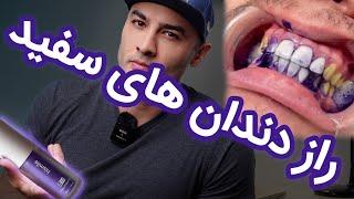 دندان های سفید بدون لمینت و کامپوزیت و هزینه های گران (356) all about purple toothpaste