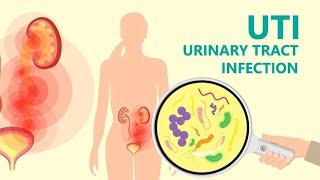 Urinary Tract Infection (UTI) Signs & Symptoms I Prevention