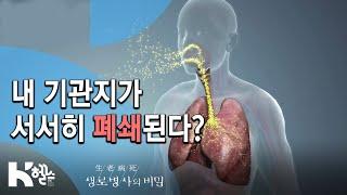 폐의 구조와 기능- 717회(19.12.04) 몰라서 더 무섭다, COPD(만성폐쇄성폐질환)