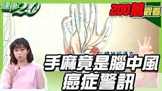 手麻竟是腦中風、癌症警訊，學會一招3分鐘告別痠痛麻！【健康2.0精選】