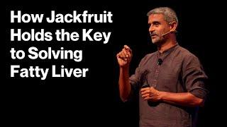 A simple solution to treat your fatty liver | James Joseph | TEDxGateway