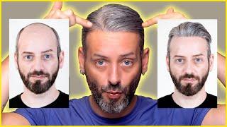 IF YOU ARE BALD YOU NEED TO TRY THIS! LIFEHACK: HAIR REPLACEMENT SYSTEM