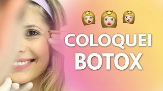 COLOQUEI BOTOX, VEJA COMO FICOU | por Carol Tognon