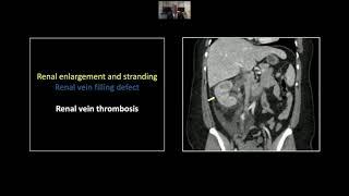 Renal Emergencies | Interesting Radiology Cases