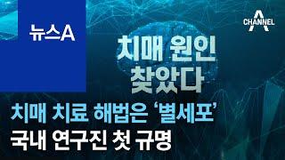 치매 치료 해법은 ‘별세포’…국내 연구진, 원인 새롭게 규명 | 뉴스A