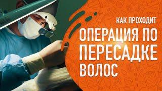 Как проходит операция по пересадке волос