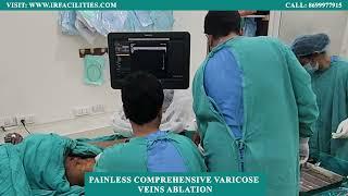 Painless Comprehensive Varicose Veins Ablation by Dr. Sandeep Sharma | IRFACILITIES