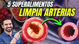 DESCUBRE 5 Alimentos Que Pueden LIMPIAR Tus Arterias Diariamente 