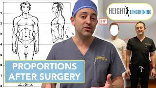 Will My Body Be Proportional After Limb Lengthening Surgery? | Height Lengthening FAQs