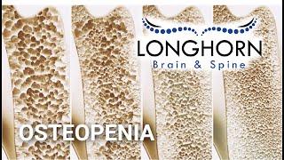 Longhorn Brain and Spine - Osteopenia