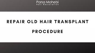 Repair Old Hair Transplant Procedure with Dr. Parsa Mohebi