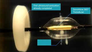 Paradise Ultrasound Renal Denervation system Gel Model demo video