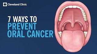 7 Ways to Prevent Oral Cancer