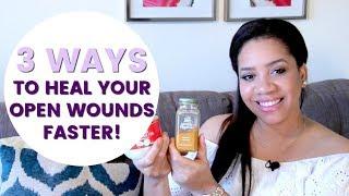 3 Natural Ways To Heal Your Open HS Wounds Faster!