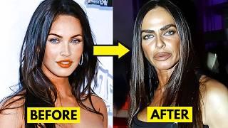 20 People Who Had Extreme Plastic Surgery